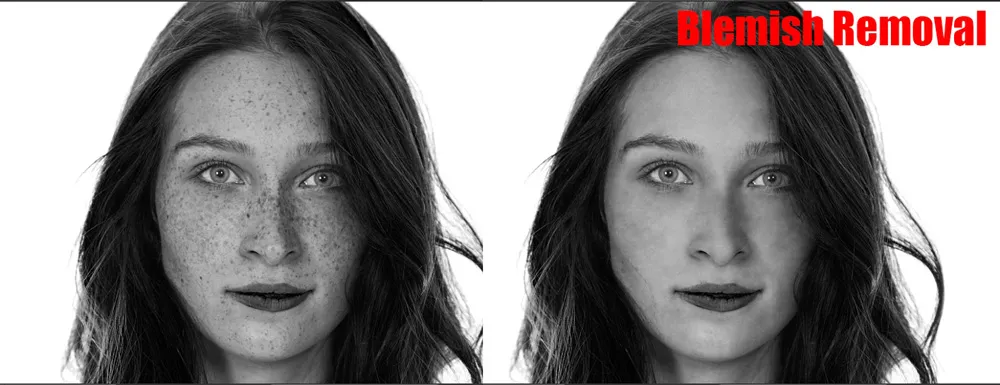 Skin Retouching 14 before and after removing blemishes